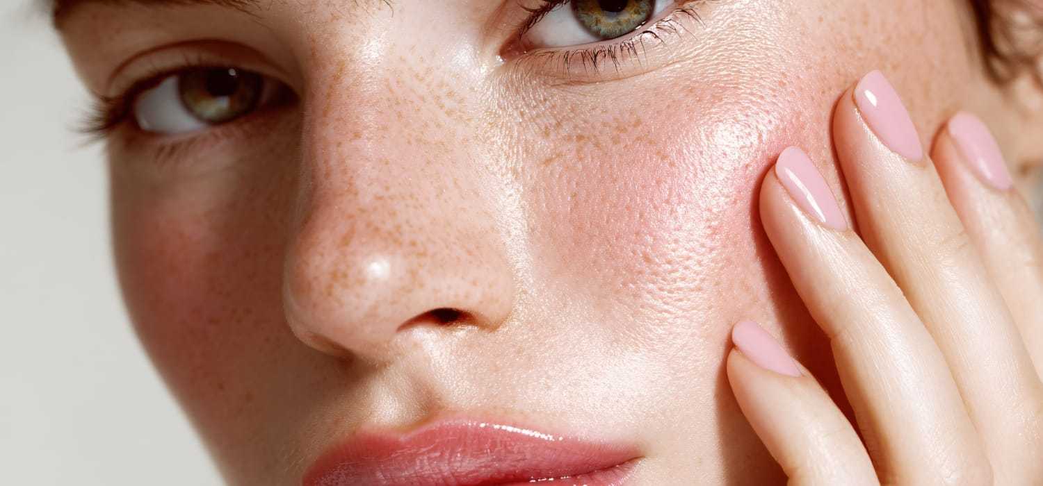 Close-up of a woman's face with freckles, pink nails touching her cheek.
